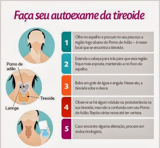 Quais diferenças entre Hipotiroidismo e Hipertiroidismo? | DentCare